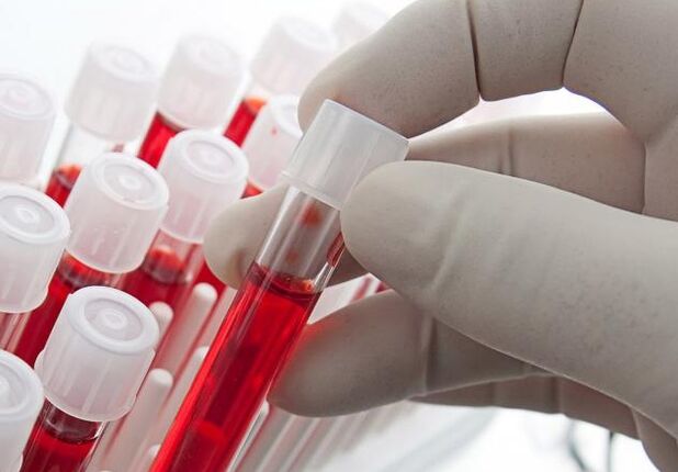 аналіз крыві пасля ўжывання алкаголю